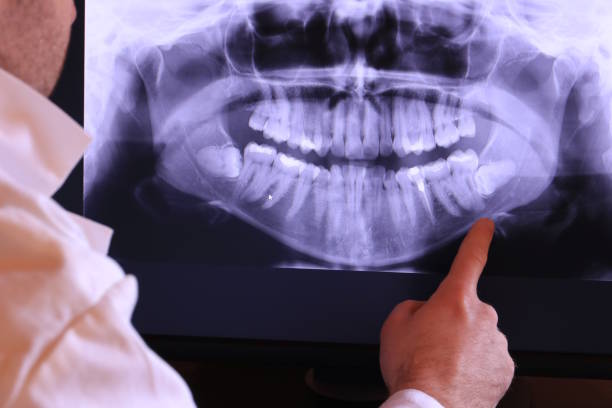 Best 24-Hour Emergency Dentist in Cabin John, MD