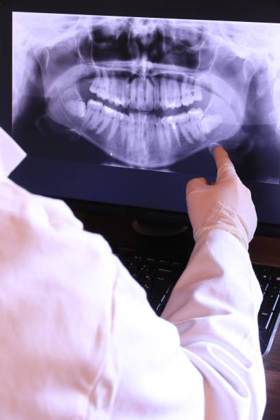 Best Emergency Treatment for Dental Infections or Abscesses in Cabin John, MD