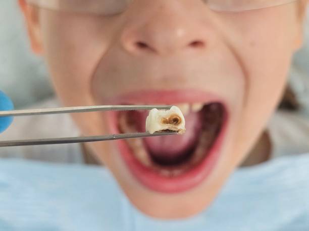 Best Weekend Emergency Dentist in Cabin John, MD